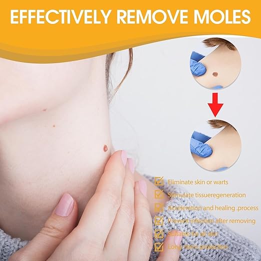 Bee Venom Wart Removal Spray | بخاخ إزالة الثآليل بسم النحل
