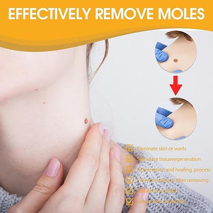 Bee Venom Wart Removal Spray | بخاخ إزالة الثآليل بسم النحل
