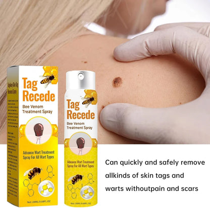 Bee Venom Wart Removal Spray | بخاخ إزالة الثآليل بسم النحل